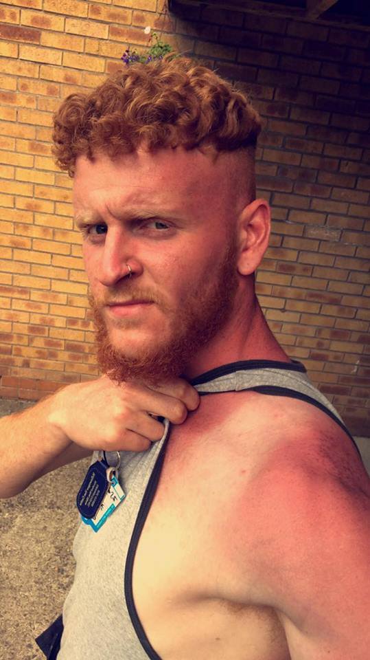 Gardener’s warning after severe sunburn shock