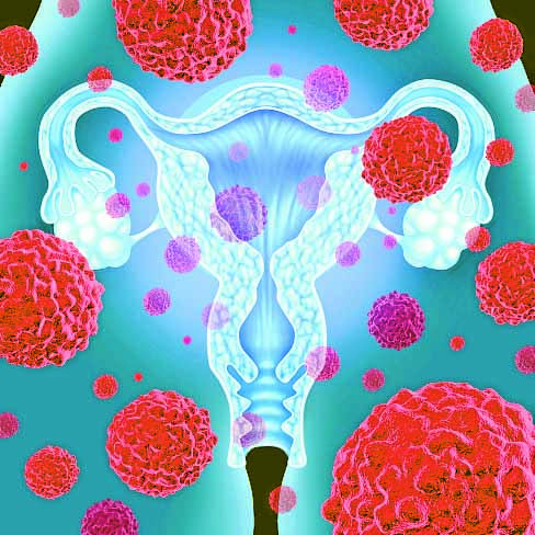 New cancer test welcomed